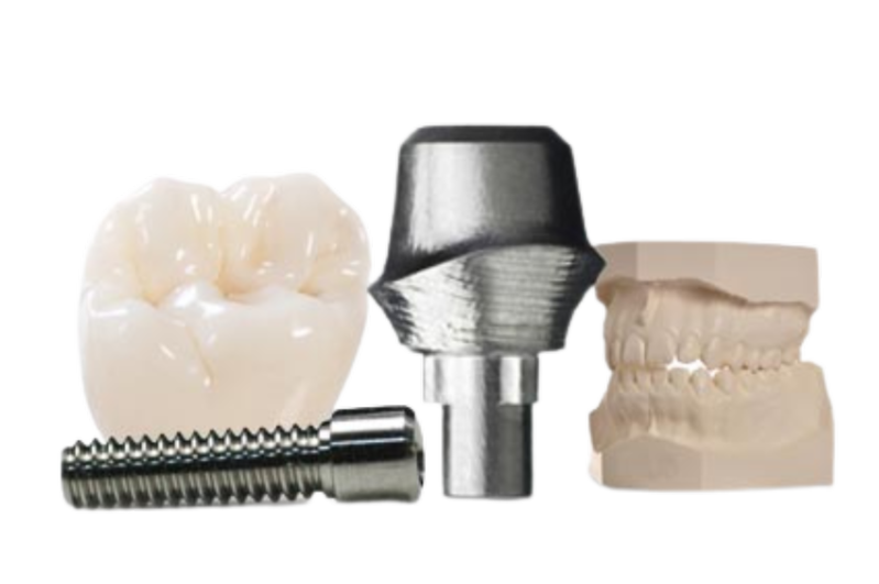 Services.Fixed.Implants