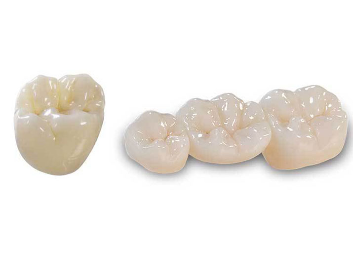 zirconia-crowns-1